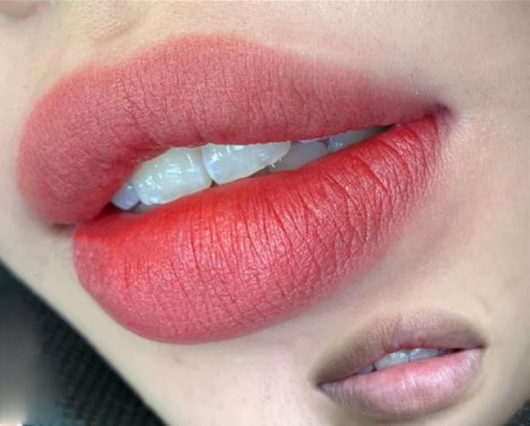 CÓ NÊN XỬ LÝ MÔI THÂM TRƯỚC KHI PHUN KHÔNG