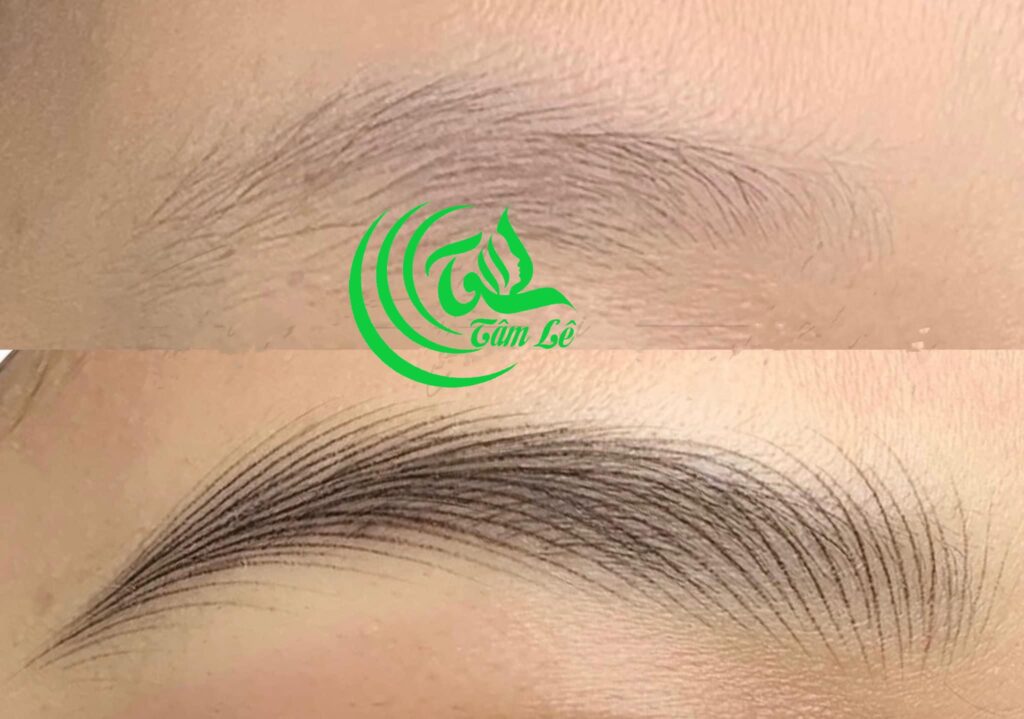 sửa chân mày hư ở Phun xăm tâm lê