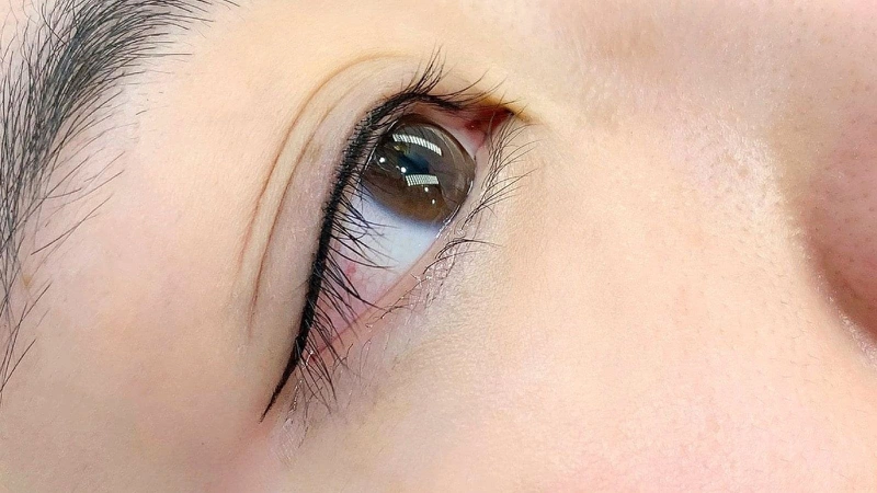 Hình ảnh <yoastmark class=