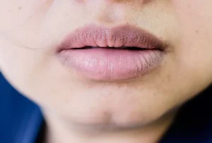 Phun môi bị thâm phải làm sao và cách khắc phục tại Phun Xăm Tâm Lê